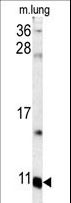 S100A6 / Calcyclin Antibody - Western blot of S100A6 antibody in mouse lung tissue lysates (35 ug/lane). S100A6 (arrow) was detected using the purified antibody.