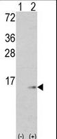 S100A6 / Calcyclin Antibody - Western blot of S100A6 (arrow) using rabbit polyclonal S100A6 Antibody.293 cell lysates (2 ug/lane) either nontransfected (Lane 1) or transiently transfected with the S100A6 gene (Lane 2) (Origene Technologies).