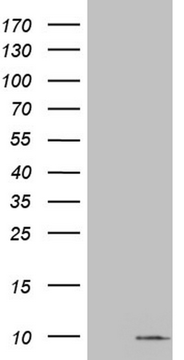 S100A6 / Calcyclin Antibody - HEK293T cells were transfected with the pCMV6-ENTRY control (Left lane) or pCMV6-ENTRY S100A6 (Right lane) cDNA for 48 hrs and lysed. Equivalent amounts of cell lysates (5 ug per lane) were separated by SDS-PAGE and immunoblotted with anti-S100A6.