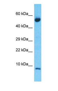 S100A6 / Calcyclin Antibody - Western blot of S10A6 Antibody with human Lung Tumor lysate.  This image was taken for the unconjugated form of this product. Other forms have not been tested.