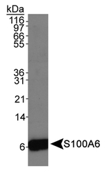 S100A6 / Calcyclin Antibody - S100A6 Antibody Detection of S100A6 antibody in Hela whole cell extracts.