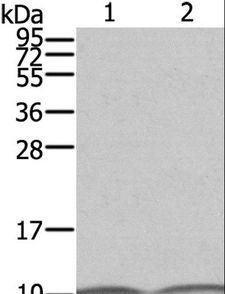 S100A6 / Calcyclin Antibody - Western blot analysis of SKOV3 and A431 cell, using S100A6 Polyclonal Antibody at dilution of 1:550.