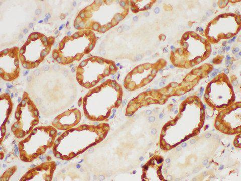 S100A6 / Calcyclin Antibody - Immunohistochemistry of paraffin-embedded Human kidney using S100A6 Polycloanl Antibody at dilution of 1:150.