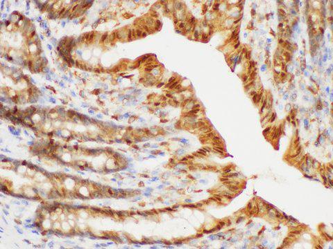 S100A6 / Calcyclin Antibody - Immunohistochemistry of paraffin-embedded Rat colon using S100A6 Polycloanl Antibody at dilution of 1:150.