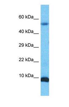 S100A6 / Calcyclin Antibody - Western blot of S10A6 Antibody with human Stomach Tumor lysate.  This image was taken for the unconjugated form of this product. Other forms have not been tested.