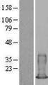 S100A6 / Calcyclin Protein - Western validation with an anti-DDK antibody * L: Control HEK293 lysate R: Over-expression lysate