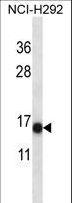 S100A7 / Psoriasin Antibody - S100A7 Antibody western blot of NCI-H292 cell line lysates (35 ug/lane). The S100A7 antibody detected the S100A7 protein (arrow).