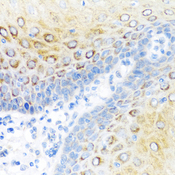 S100A7 / Psoriasin Antibody - Immunohistochemistry of paraffin-embedded human esophagus.