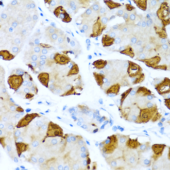 S100A7 / Psoriasin Antibody - Immunohistochemistry of paraffin-embedded human stomach tissue.