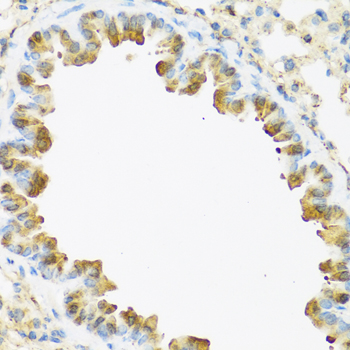 S100A7 / Psoriasin Antibody - Immunohistochemistry of paraffin-embedded mouse lung tissue.