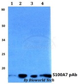 S100A7 / Psoriasin Antibody - Western blot of S100A7 antibody at 1:500 dilution. Lane 1: HEK293T whole cell lysate. Lane 2: sp2/0 whole cell lysate. Lane 3: H9C3 whole cell lysate.