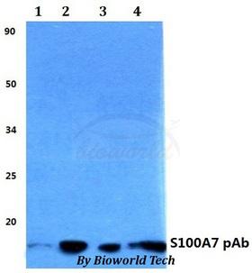 S100A7 / Psoriasin Antibody - Western blot of S100A7 antibody at 1:500 dilution. Lane 1: HEK293T whole cell lysate. Lane 2: sp2/0 whole cell lysate. Lane 3: H9C3 whole cell lysate.