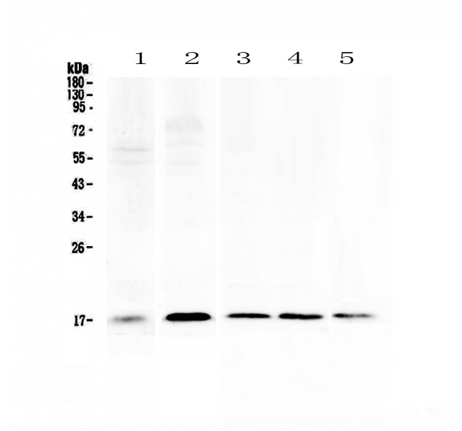 S100A7 / Psoriasin Antibody - Western blot - Anti-Psoriasin Picoband antibody