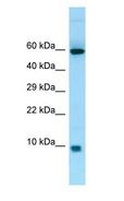 S100A7A / S100A15 Antibody - S100A7A / S100A15 antibody Western Blot of Fetal Heart.  This image was taken for the unconjugated form of this product. Other forms have not been tested.