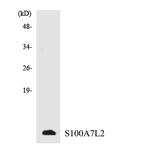 S100A7L2 Antibody - Western blot analysis of the lysates from HepG2 cells using S100A7L2 antibody.