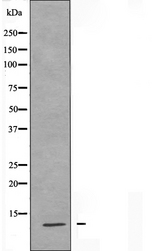 S100A7L2 Antibody - Western blot analysis of extracts of HuvEc cells using S100A7L2 antibody.