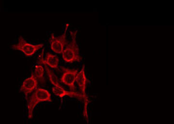 S100A7L2 Antibody - Staining HuvEc cells by IF/ICC. The samples were fixed with PFA and permeabilized in 0.1% Triton X-100, then blocked in 10% serum for 45 min at 25°C. The primary antibody was diluted at 1:200 and incubated with the sample for 1 hour at 37°C. An Alexa Fluor 594 conjugated goat anti-rabbit IgG (H+L) Ab, diluted at 1/600, was used as the secondary antibody.