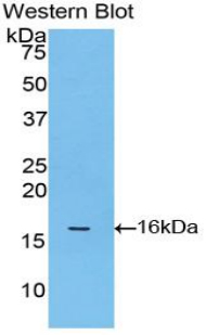 S100A8 / MRP8 Antibody - Western blot of recombinant S100A8 / MRP8.  This image was taken for the unconjugated form of this product. Other forms have not been tested.