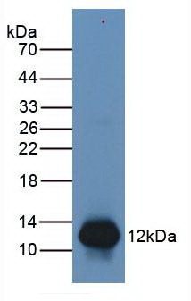 S100A8 / MRP8 Antibody - Western Blot; Sample: Human Leukocytes Cells.