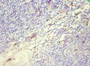 S100A8 / MRP8 Antibody - Immunohistochemistry of paraffin-embedded human tonsil tissue using antibody at 1:100 dilution..