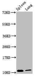 S100A8 / MRP8 Antibody - Western Blot Positive WB detected in: Mouse spleen tissue, Mouse lung tissue All lanes: S100a8 antibody at 3.8µg/ml Secondary Goat polyclonal to rabbit IgG at 1/50000 dilution Predicted band size: 11 kDa Observed band size: 11 kDa