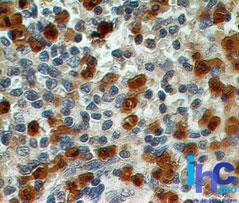 S100A8 / MRP8 Antibody - Immunohistochemistry-Paraffin: S100A8/A9 Antibody (48M7C7) - Formalin-fixed, paraffin-embedded human spleen stained with S100A8 antibody (2 ug/ml), peroxidase-conjugate and DAB chromogen. TMA was used for this test.