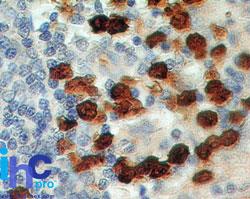 S100A8 / MRP8 Antibody - Immunohistochemistry-Paraffin: S100A8/A9 Antibody (48M7F9) - Formalin-fixed, paraffin-embedded human spleen stained with S100A8 antibody (2 ug/ml), peroxidase-conjugate and DAB chromogen. TMA was used for this test.