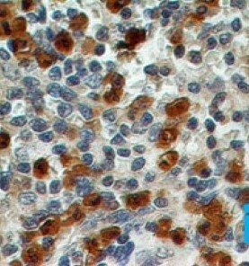 S100A8 / MRP8 Antibody - Immunohistochemistry-Paraffin: S100A8/A9 Antibody (48M7C7) [Azide Free] - Formalin-fixed, paraffin-embedded human spleen stained with S100A8 antibody (2 ug/ml), peroxidase-conjugate and DAB chromogen. TMA was used for this test. This image was taken for the unmodified form of this product. Other forms have not been tested.