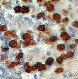 S100A8 / MRP8 Antibody - Immunohistochemistry-Paraffin: S100A8/A9 Antibody (48M7F9) [Azide Free] - Formalin-fixed, paraffin-embedded human spleen stained with S100A8 antibody (2 ug/ml), peroxidase-conjugate and DAB chromogen. TMA was used for this test. This image was taken for the unmodified form of this product. Other forms have not been tested.