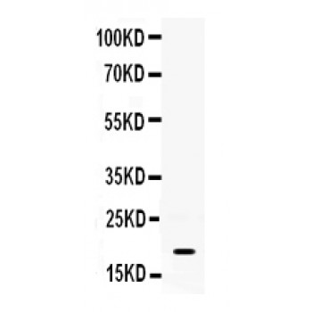 S100A8 / MRP8 Antibody - MRP8 antibody Western blot. All lanes: Anti MRP8 at 0.5 ug/ml. WB: Mouse Spleen Tissue Lysate at 50 ug. Predicted band size: 19 kD. Observed band size: 19 kD.