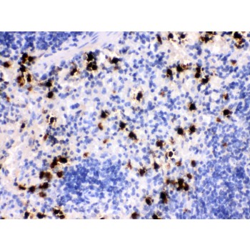 S100A8 / MRP8 Antibody - MRP8 antibody IHC-paraffin. IHC(P): Mouse Spleen Tissue.