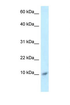 S100A8 / MRP8 Antibody - S100A8 antibody Western blot of ACHN Cell lysate. Antibody concentration 1 ug/ml.  This image was taken for the unconjugated form of this product. Other forms have not been tested.