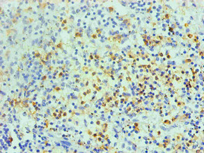 S100A8 / MRP8 Antibody - Immunohistochemical of paraffin-embedded human spleen using S100A8 Monoclonal Antibody at dilution of 1:200
