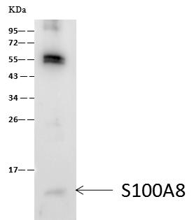 S100A8 / MRP8 Antibody - S100A8 was immunoprecipitated using: Lane A: 0.5 mg HL-60 Whole Cell Lysate. 1 uL anti-S100A8 rabbit monoclonal antibody and 60 ug of Immunomagnetic beads Protein A/G. Primary antibody: Anti-S100A8 rabbit monoclonal antibody, at 1:500 dilution. Secondary antibody: Goat Anti-Rabbit IgG (H+L)/HRP at 1/10000 dilution. Developed using the ECL technique. Performed under reducing conditions. Predicted band size: 11 kDa. Observed band size: 11 kDa.