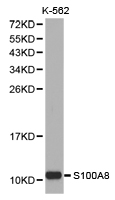 S100A8 / MRP8 Antibody - Western blot of extracts of K-562 cell lines, using S100A8 antibody.