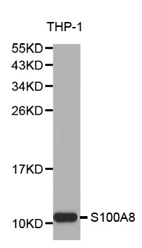 S100A8 / MRP8 Antibody - Western blot analysis of extracts of THP-1 cell lines.