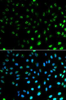 S100A8 / MRP8 Antibody - Immunofluorescence analysis of MCF7 cells.