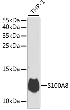 S100A8 / MRP8 Antibody - Western blot analysis of extracts of various cell lines, using S100A8 antibody at 1:1000 dilution. The secondary antibody used was an HRP Goat Anti-Rabbit IgG (H+L) at 1:10000 dilution. Lysates were loaded 25ug per lane and 3% nonfat dry milk in TBST was used for blocking. An ECL Kit was used for detection.