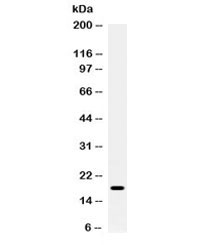 S100A8 / MRP8 Antibody