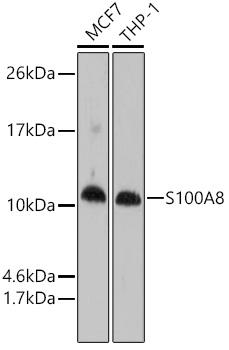 S100A8 / MRP8 Antibody - Western blot analysis of extracts of various cell lines using S100A8 Polyclonal Antibody at dilution of 1:1000.