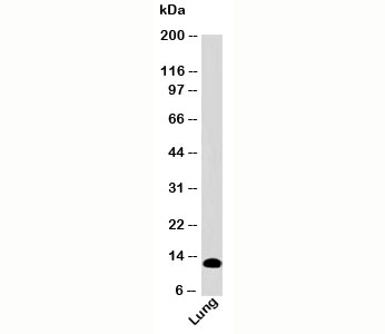 S100A8 / MRP8 Antibody - S100A8 antibody western blot of human samples
