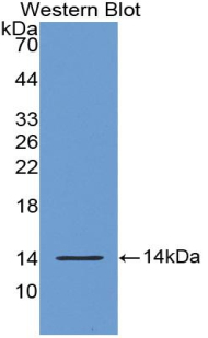 S100A9 / MRP14 Antibody - Western blot of recombinant S100A9 / MRP14. This image was taken for the unconjugated form of this product. Other forms have not been tested.
