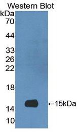 S100A9 / MRP14 Antibody - Western blot of S100A9 / MRP14 antibody.
