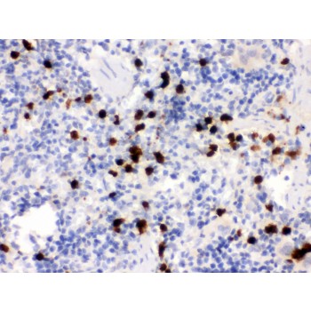 S100A9 / MRP14 Antibody - S100A9 antibody IHC-paraffin. IHC(P): Rat Spleen Tissue.