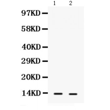 S100A9 / MRP14 Antibody - S100A9 antibody Western blot. All lanes: Anti S100A9 at 0.5 ug/ml. Lane 1: A431 Whole Cell Lysate at 40 ug. Lane 2: MCF-7 Whole Cell Lysate at 40 ug. Predicted band size: 13 kD. Observed band size: 13 kD.