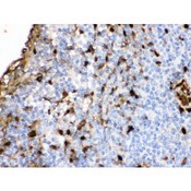 S100A9 / MRP14 Antibody - S100A9 antibody IHC-paraffin. IHC(P): Human Tonsil Tissue.