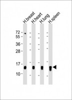 S100A9 / MRP14 Antibody - All lanes: Anti-S100A9 Antibody (Center) at 1:500-1:1000 dilution. Lane 1: human breast lysate. Lane 2: human heart lysate. Lane 3: human lung lysate. Lane 4: human spleen lysate Lysates/proteins at 20 ug per lane. Secondary Goat Anti-Rabbit IgG, (H+L), Peroxidase conjugated at 1:10000 dilution. Predicted band size: 13 kDa. Blocking/Dilution buffer: 5% NFDM/TBST.