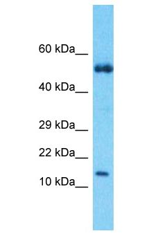 S100A9 / MRP14 Antibody - S100A9 / MRP14 antibody Western Blot of Thymus Tumor. Antibody dilution: 1 ug/ml.  This image was taken for the unconjugated form of this product. Other forms have not been tested.