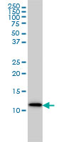 S100A9 / MRP14 Antibody - S100A9 monoclonal antibody (M01A), clone 1C10 Western Blot analysis of S100A9 expression in MCF-7.