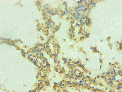 S100A9 / MRP14 Antibody - Immunohistochemical of paraffin-embedded human lung tissue using S100A9 Monoclonal Antibody at dilution of 1:200